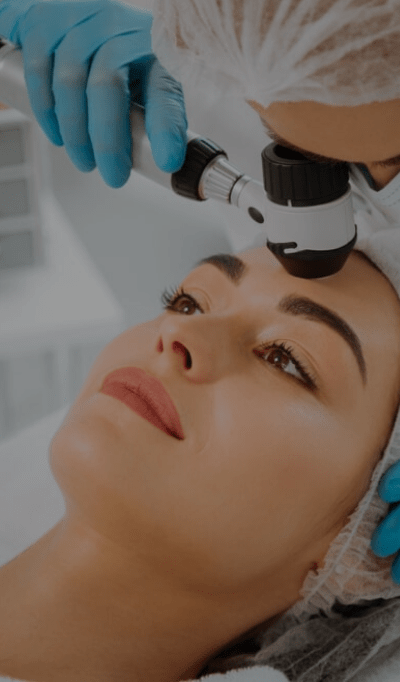 Fraxel laser treatment