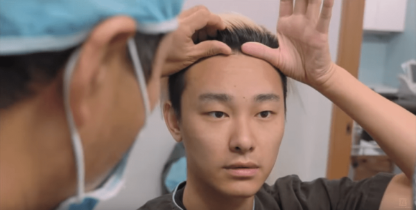 Haeppy from the Youtube channel We Fancy came to have his FUE Hair Transplant through Seoul Guide Medical